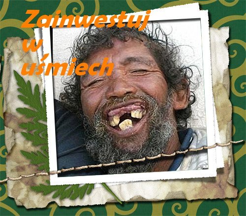 Zainwestuj  w  uśmiech.  Mówią ,ze uśmiech nic nie kosztuje?