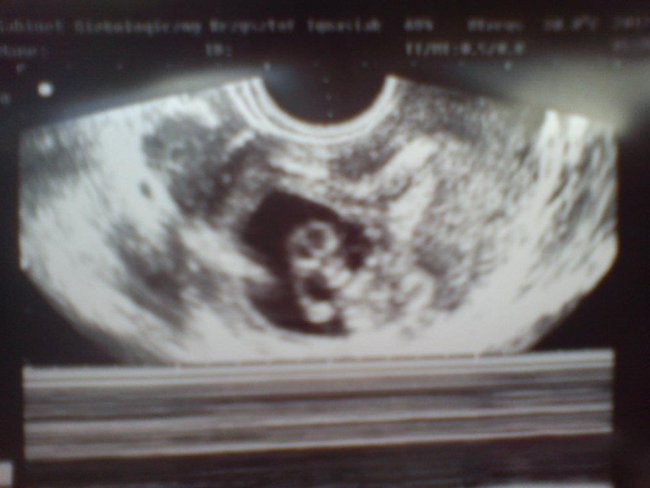 2 Latka mojej Coreczki