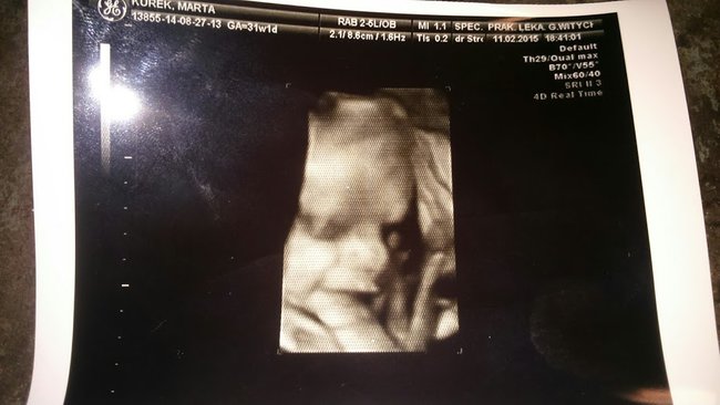 w oczekiwaniu na syna