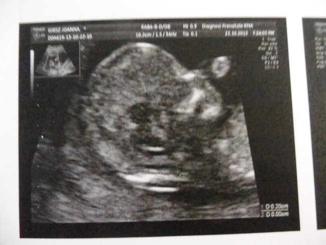 Il 1 anno di vita del nostro piccolo ometto Antonio!